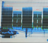 3. X-ray with AI