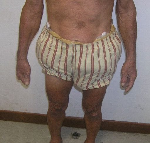 News_Releases_Cases_at_Checkpoints_3_Jul_08_2